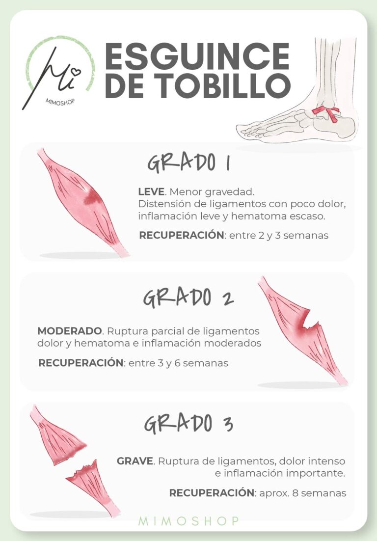 Recuperacion del esguince de tobillo - En Pucol